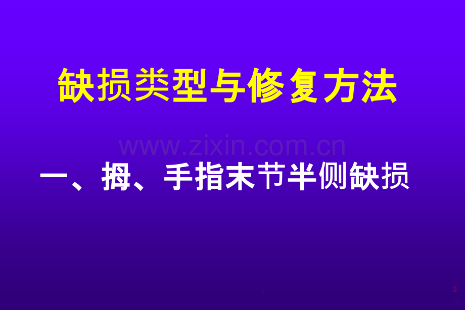 修饰性手指部分.ppt_第3页