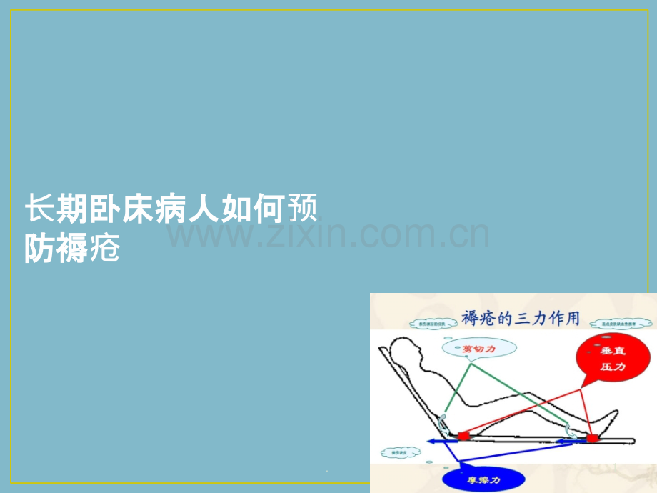 长期卧床病人如何预防褥疮.ppt_第1页