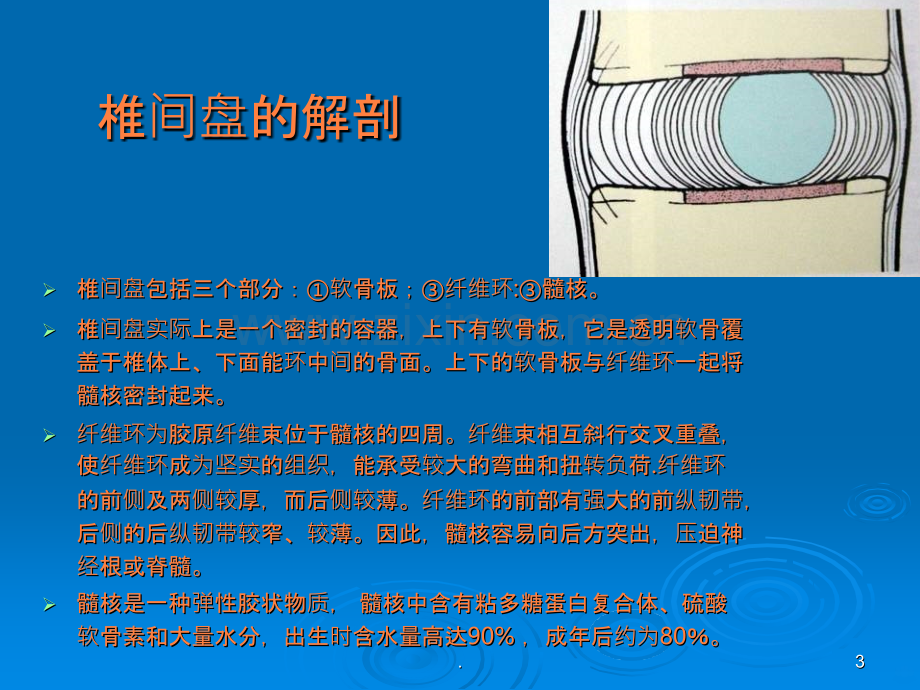 脊柱介入治疗进展臭氧椎间盘治疗ppt课件.ppt_第3页