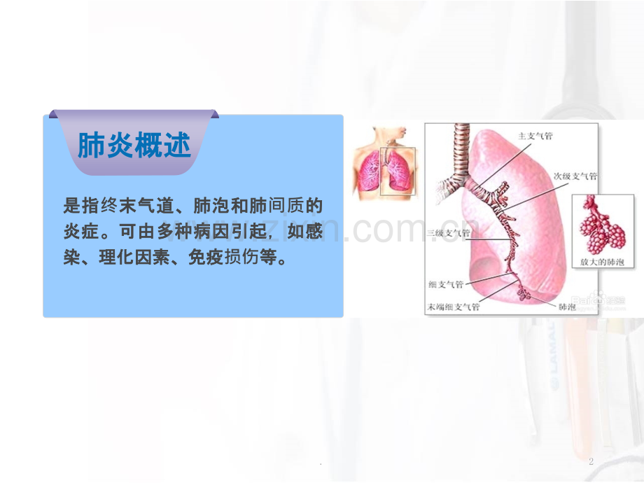 社区获得性肺炎的护理课件.ppt_第2页