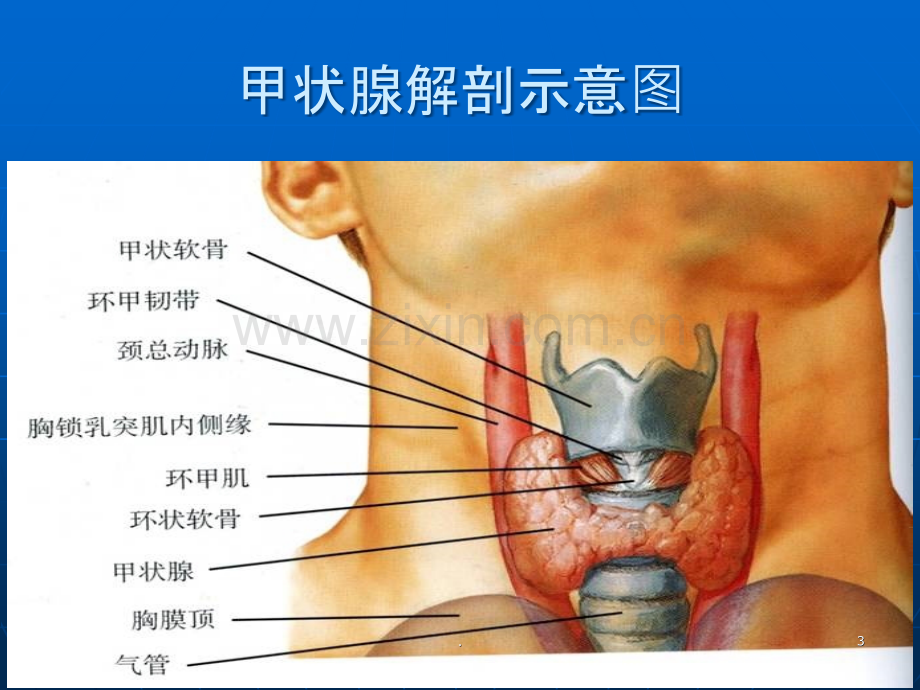 浅谈常见甲状腺疾病的超声诊断.ppt_第3页