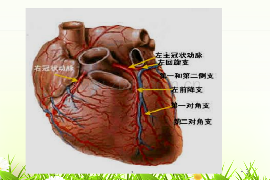 冠心病的介入治疗及术后护理.ppt_第3页