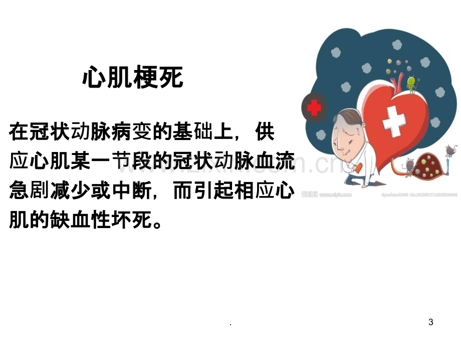 心梗患者便秘的护理课件.ppt_第3页