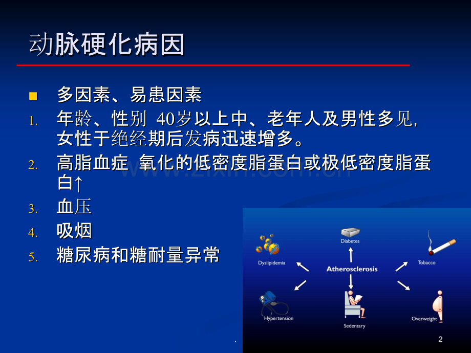 冠心病的介绍PPT.ppt_第2页