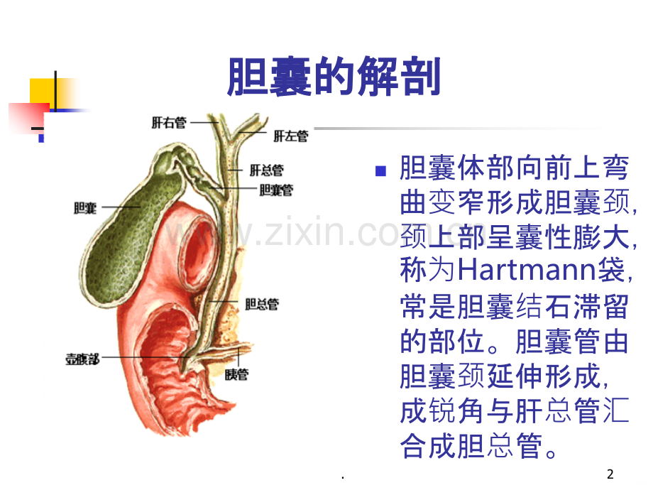 急性胆囊炎胆道引流管的护理.ppt_第2页