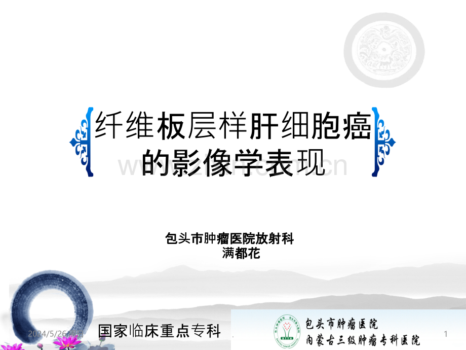 纤维板层样肝细胞癌.ppt_第1页