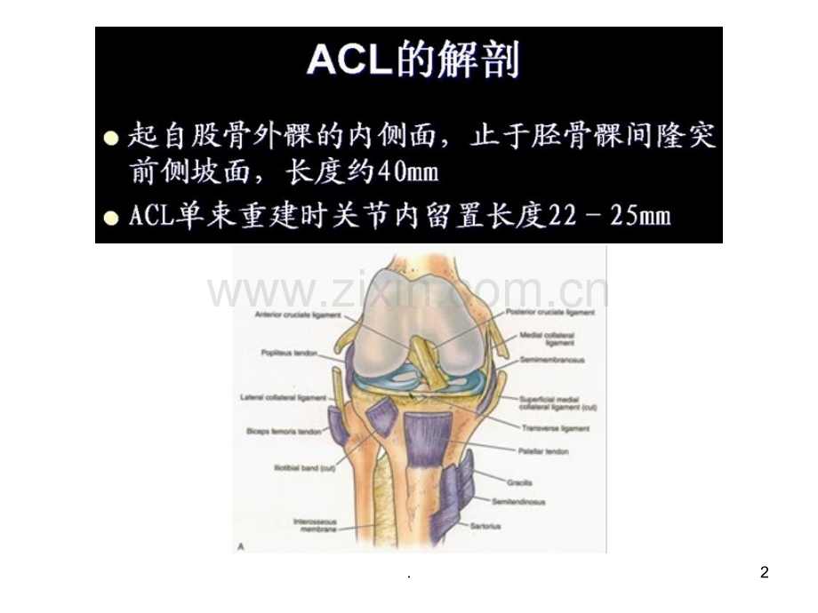 关节镜下韧带重建术.ppt_第2页