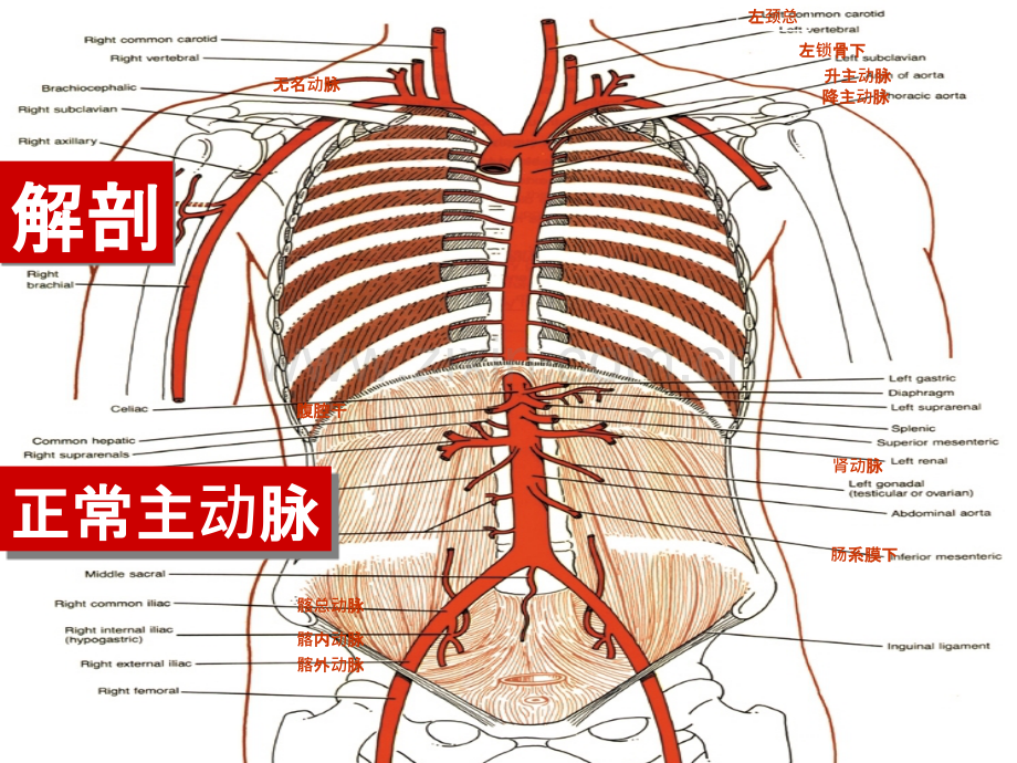 主动脉夹层的介入治疗与护理(陈冬萍)ppt课件.ppt_第3页