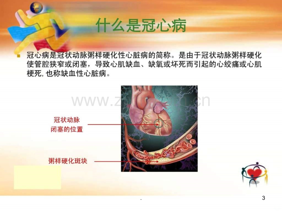 冠心病的防治-患者教育ppt课件.ppt_第3页