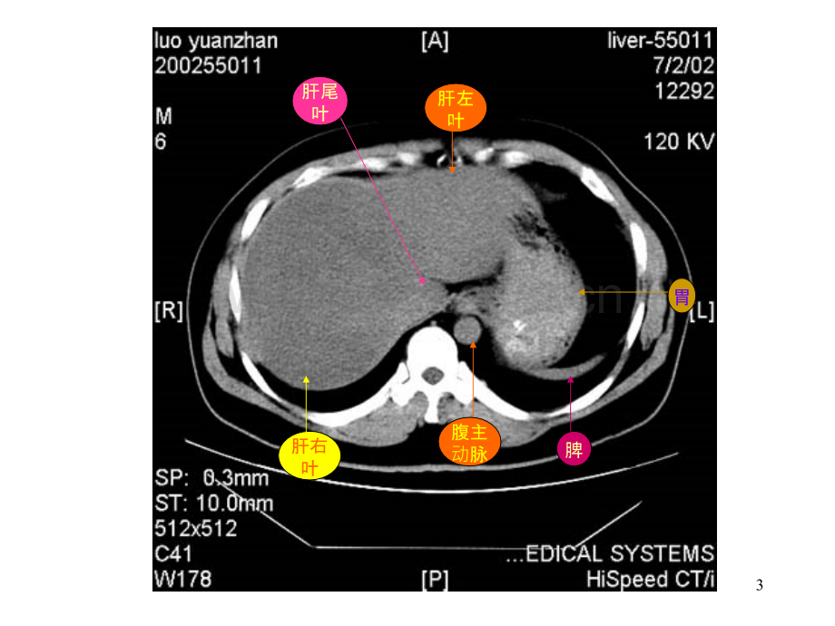 医学课件腹部【汉魅—医学专区分享】.ppt_第3页