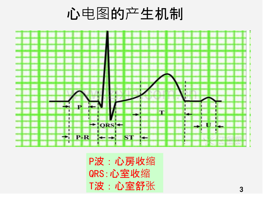 第三节心律失常病人-的护理.ppt_第3页