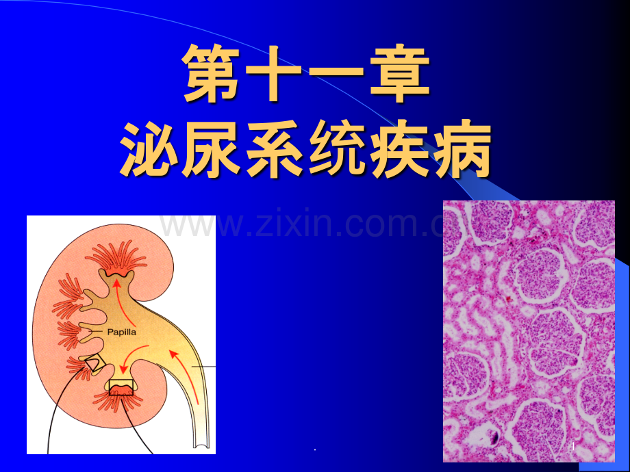 泌尿系统疾病-(3)ppt课件.ppt_第1页