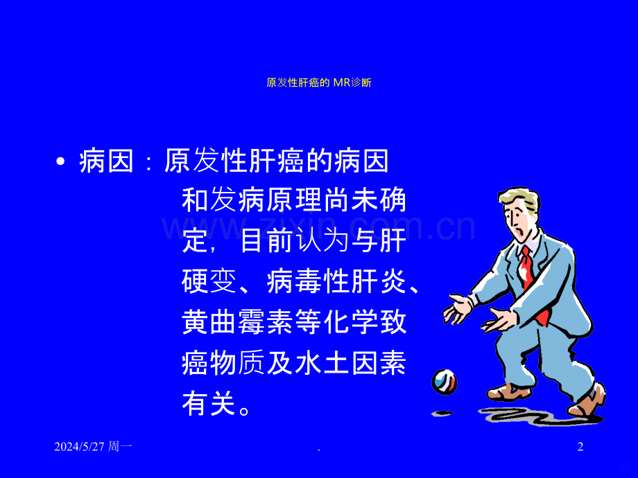 肝癌的-MR诊断.ppt_第2页