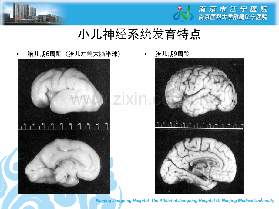 热性惊厥小讲座.ppt_第3页