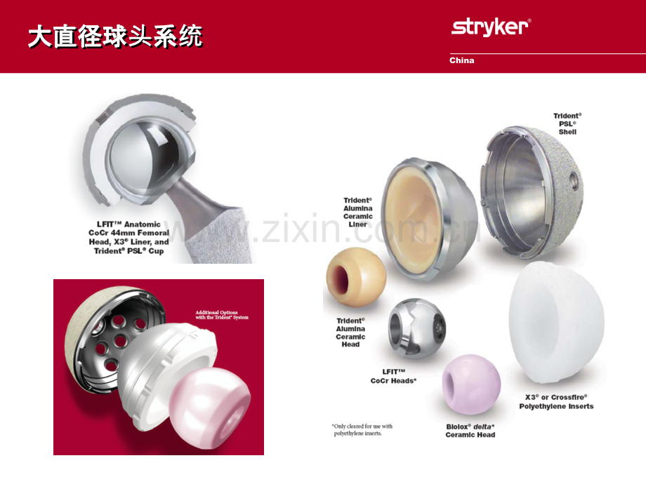 Stryker大直径球头系统产品介绍.ppt_第2页