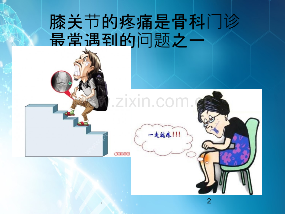 膝关节疼痛的诊断与治疗ppt课件.ppt_第2页