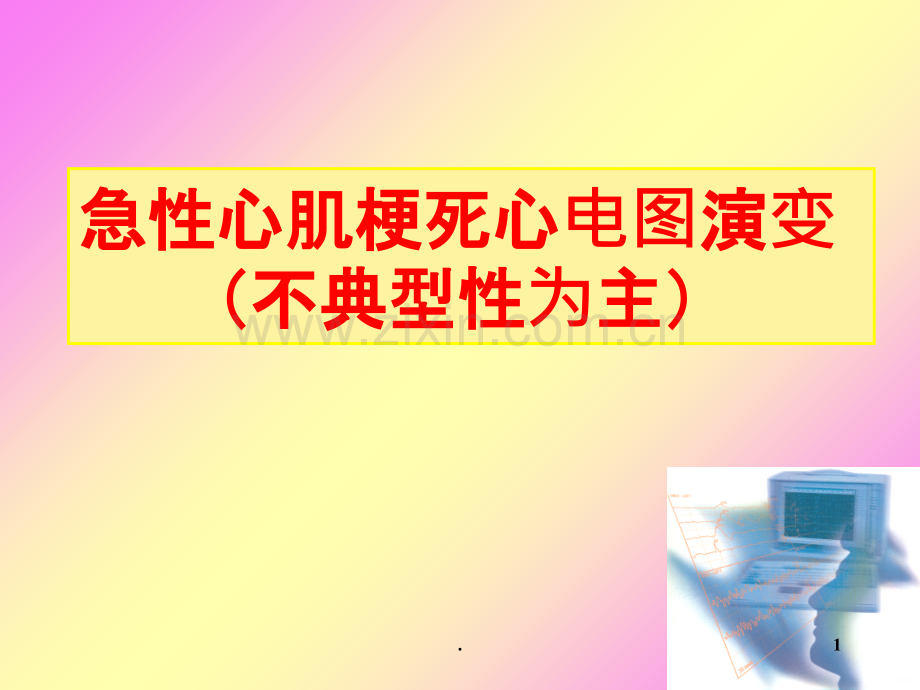 急性心肌梗死心电图演变.ppt_第1页