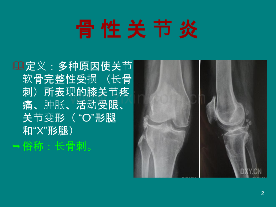 健康知识讲座膝关节ppt课件.ppt_第2页