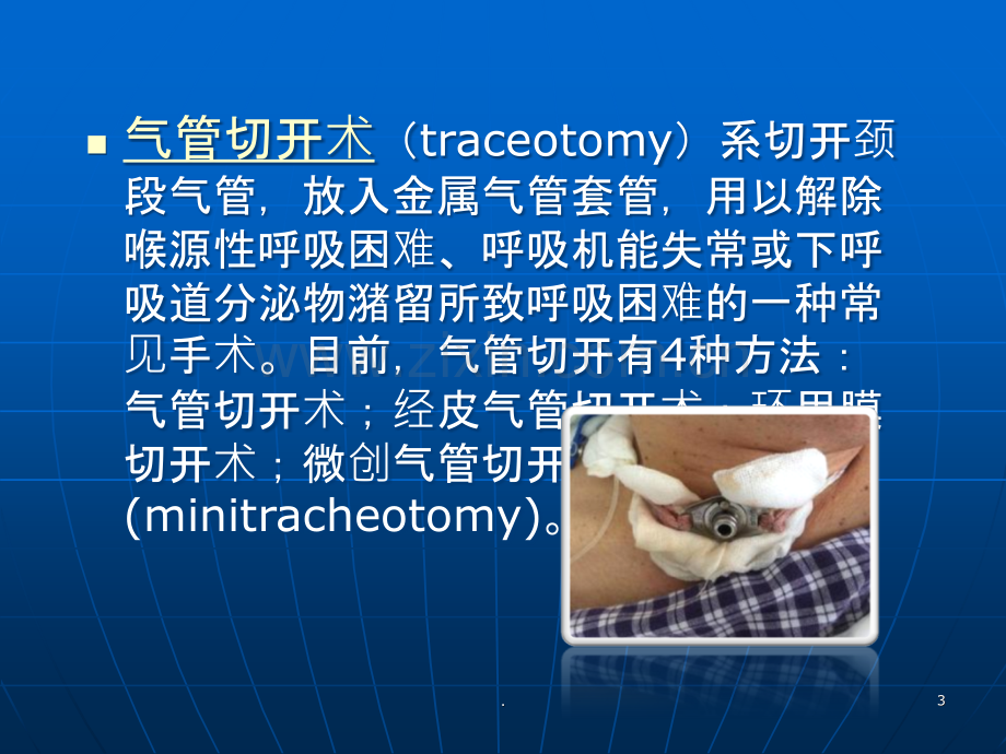 气管切开术后的护理ppt课件.ppt_第3页