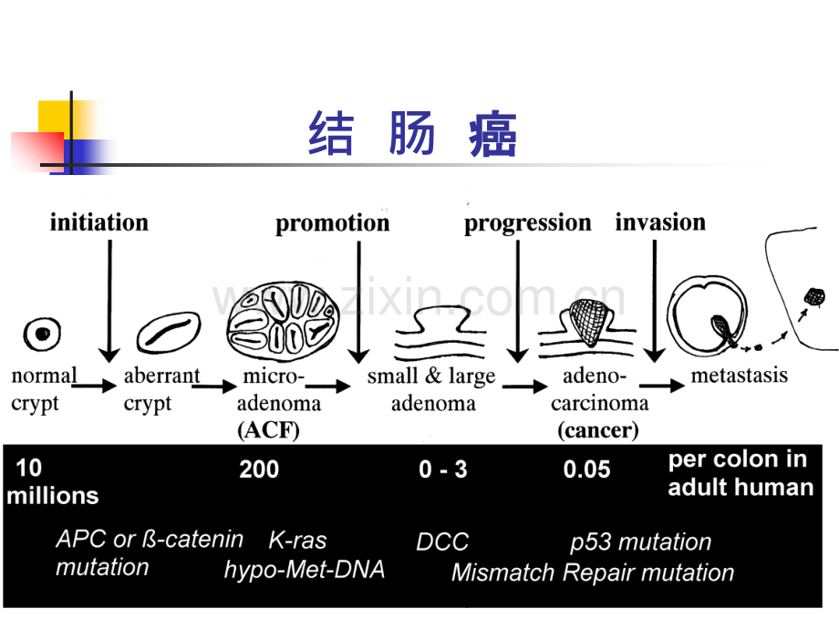 【】结肠癌.ppt_第2页