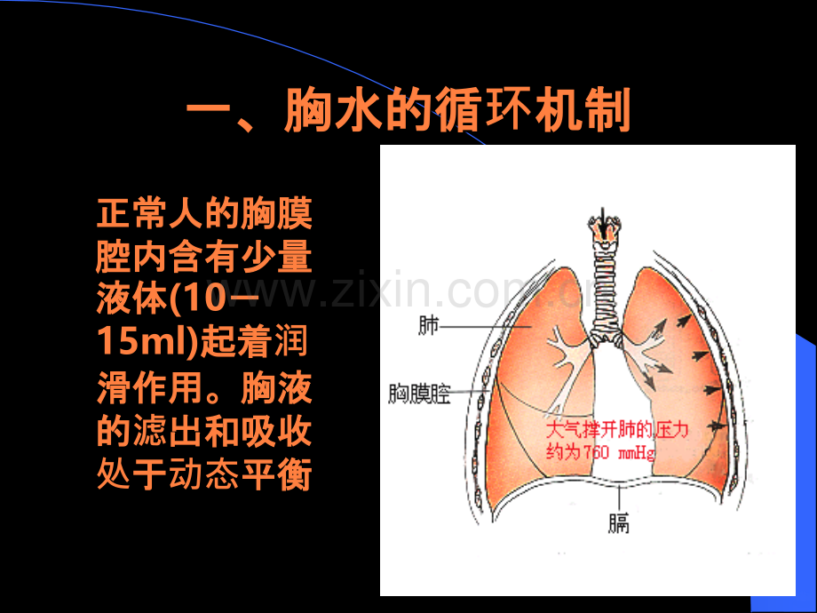 结核性胸膜炎--胸腔积液ppt课件.ppt_第2页