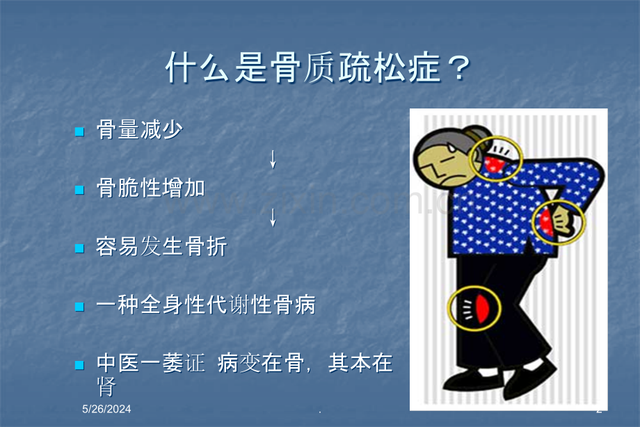 骨质疏松症ppt课件.ppt_第2页