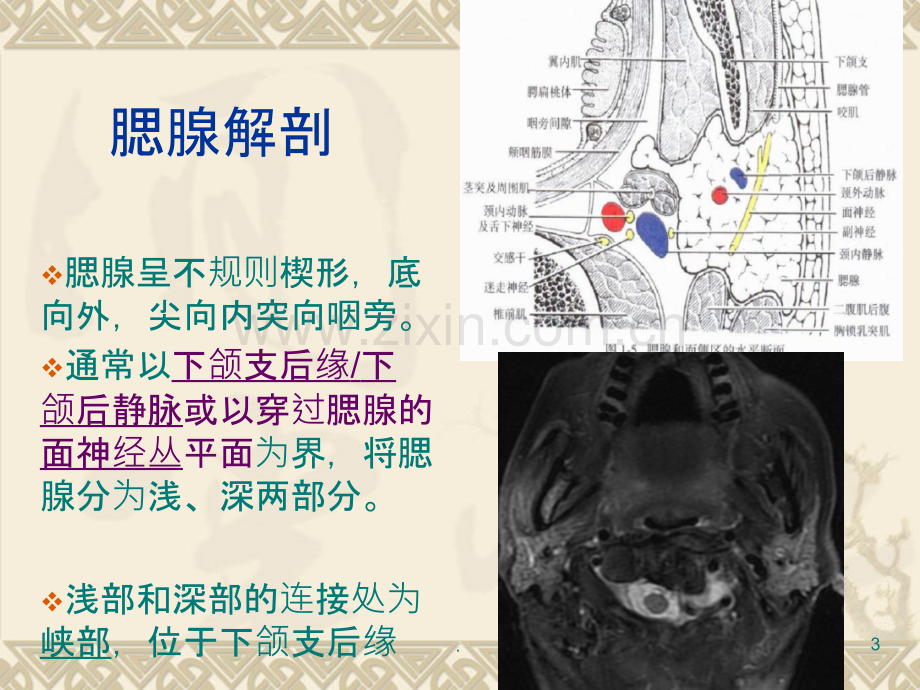 腮腺混合瘤影像诊断ppt课件.ppt_第3页