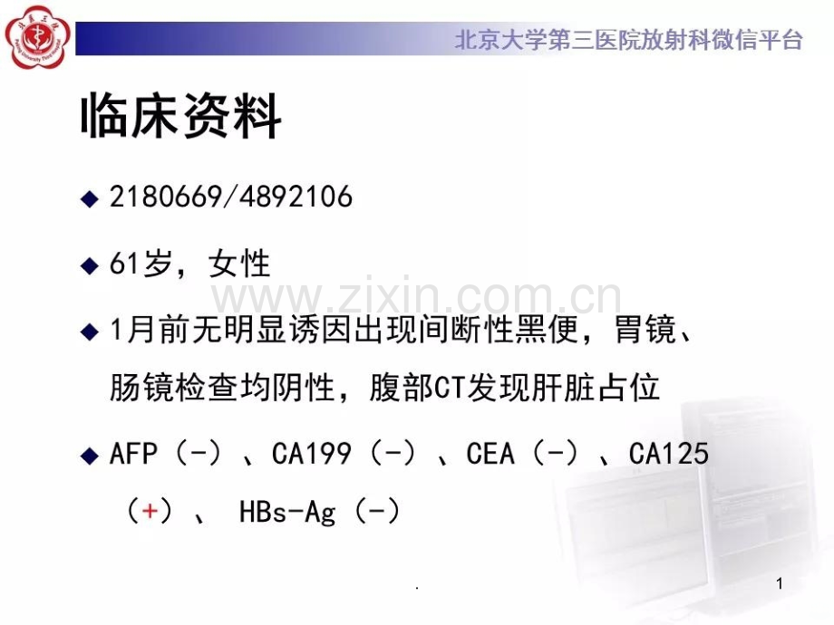 肝血管肉瘤.ppt_第1页