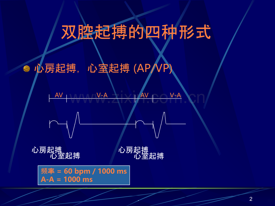 双腔起搏器技术及临床心电图表现ppt课件.ppt_第2页