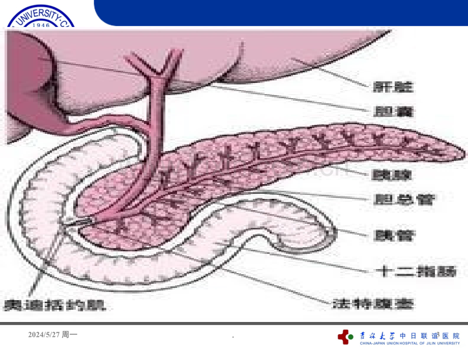 急性重症胰腺炎的护理ppt课件.ppt_第3页