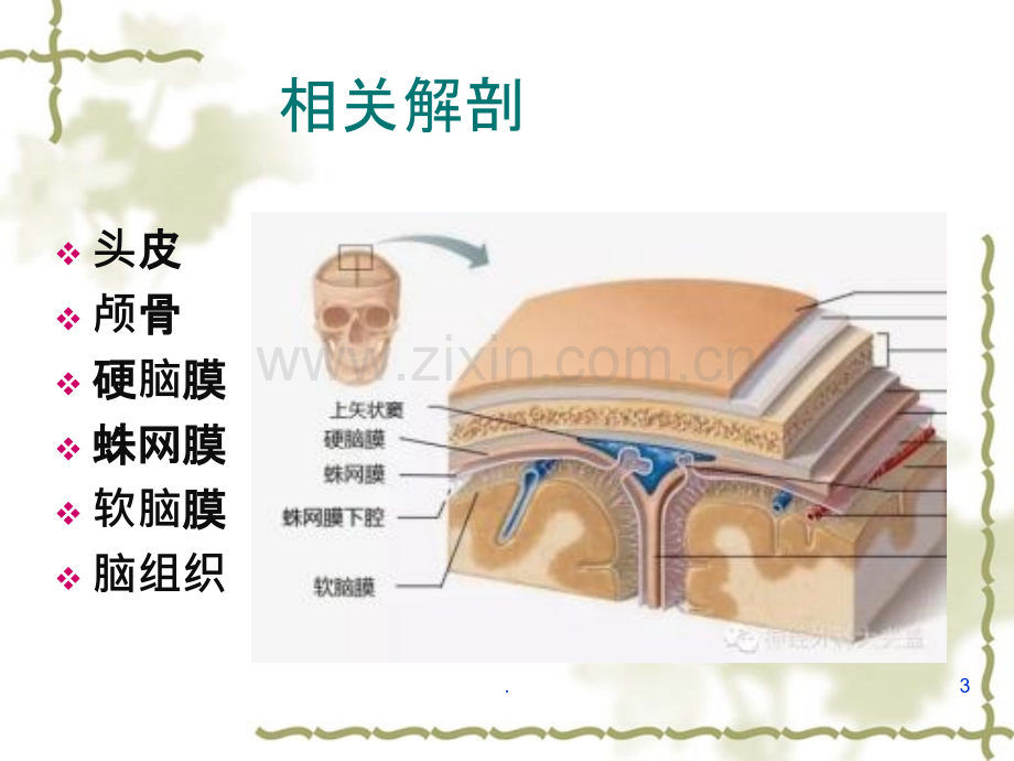 颅脑手术护理配合.ppt_第3页