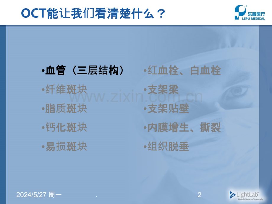 OCT培训图像分析.ppt_第2页