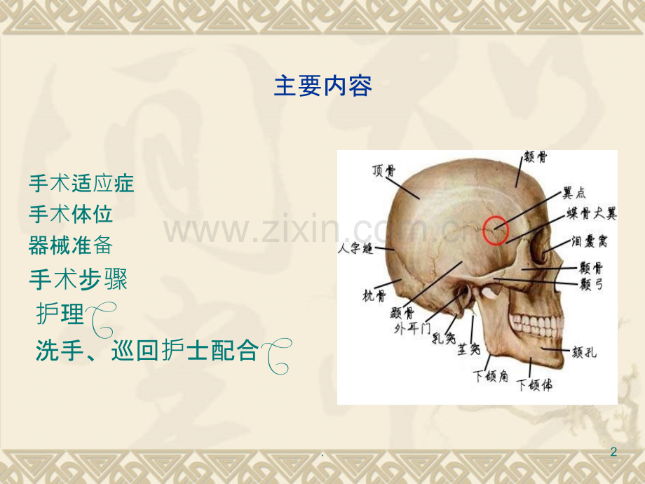 急性硬膜下血肿清除术的手术配合.ppt_第2页