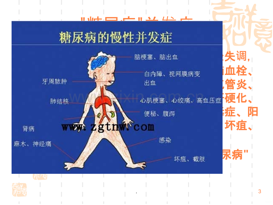 社区康复糖尿病ppt课件.ppt_第3页