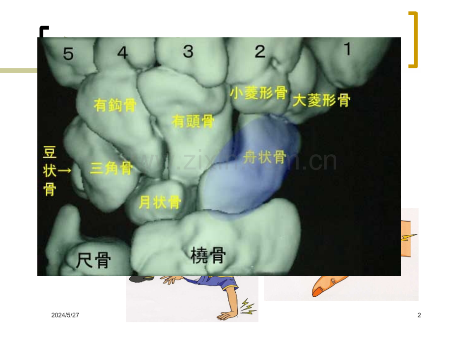 运动伤害与贴扎.ppt_第2页