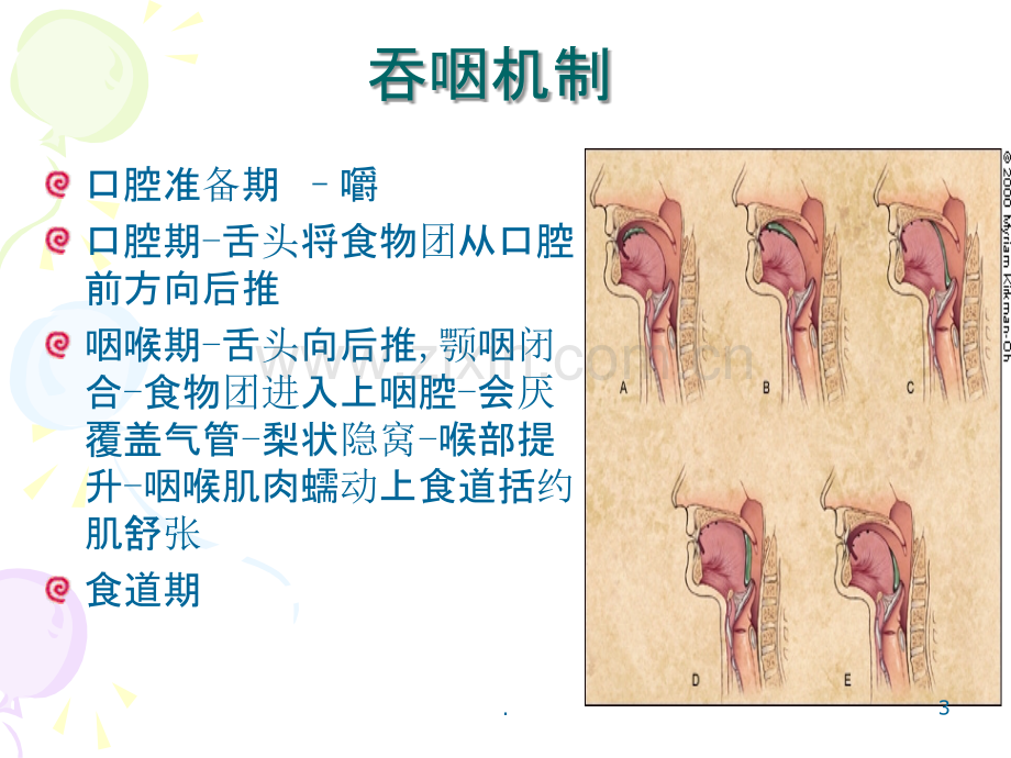 老年患者进食安全护理.ppt_第3页