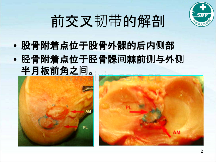 浅谈前交叉韧带损伤.ppt_第2页