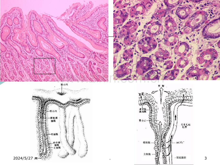 消化系统疾病.ppt_第3页