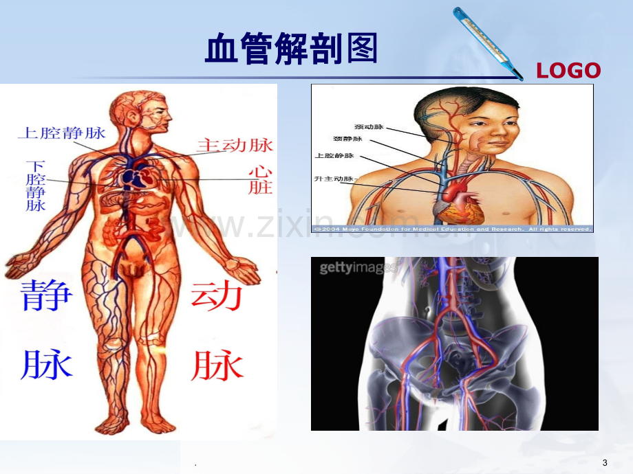 血管外科.ppt_第3页