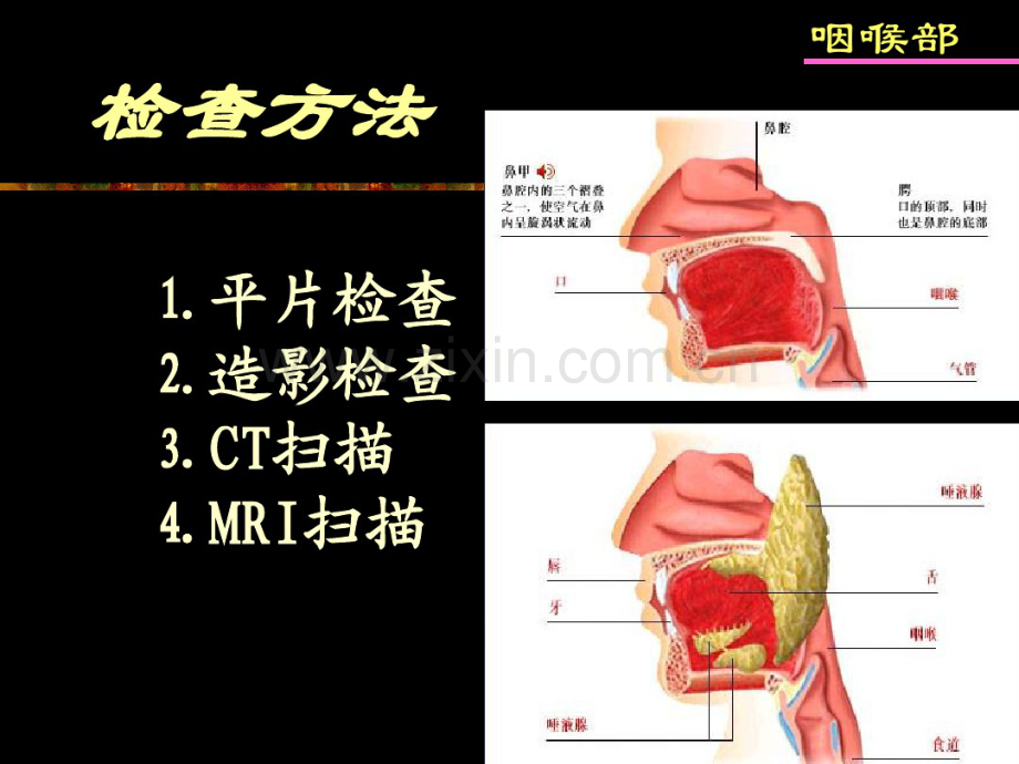 咽喉疾病影像诊断.pdf_第3页