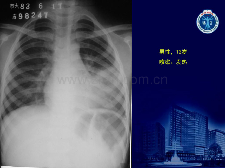 X线读片练习.pdf_第3页