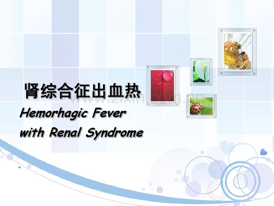 HFRS-本2013.pdf_第1页