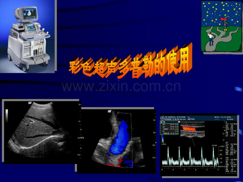 彩色超声在临床诊断中的应用价值(一).pdf_第1页