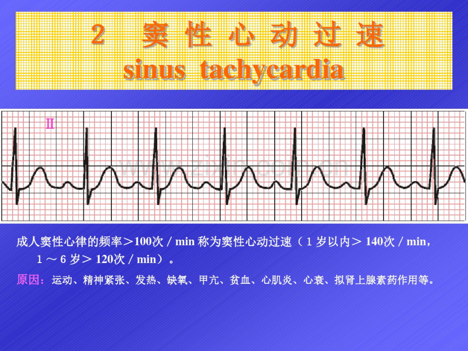 心电图学.pdf_第3页