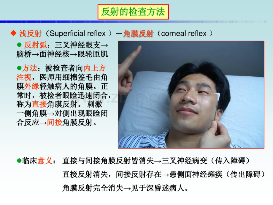 反射检查.pdf_第3页