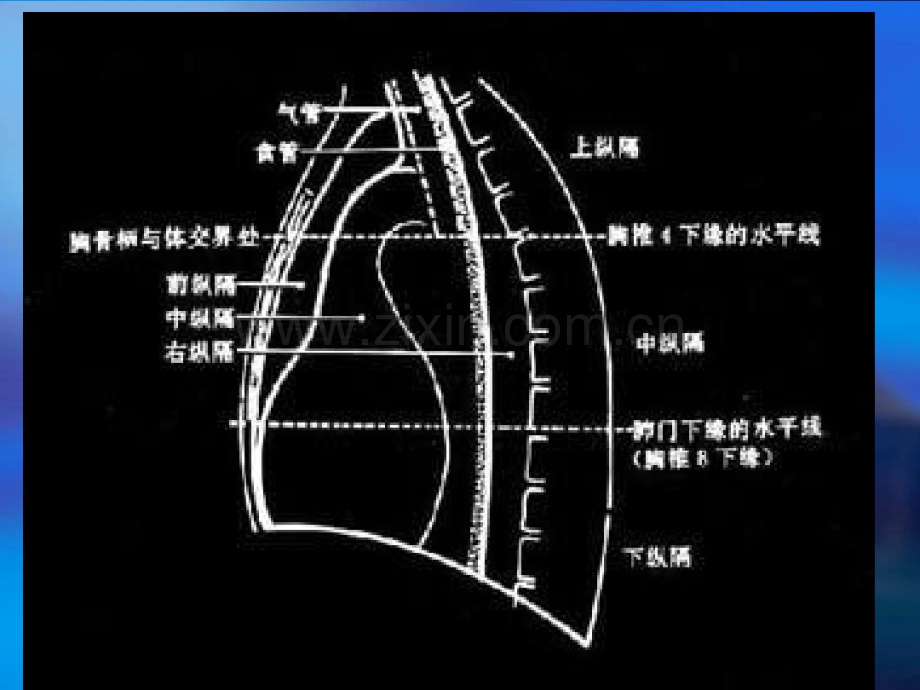 纵隔病变.pdf_第3页