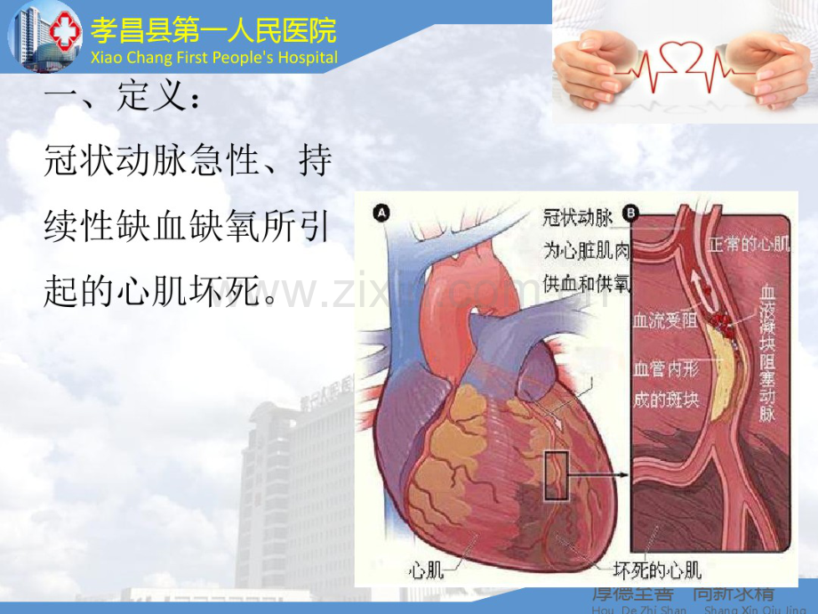 急性心肌梗死急救流程.pdf_第2页