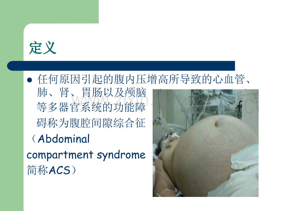 ACS-腹腔间隙综合症(可编辑修改).ppt_第2页