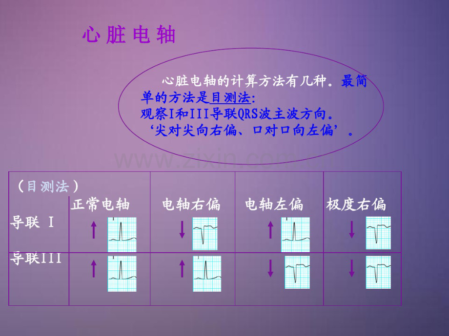 常见异常心电图(20190901095201).pdf_第2页