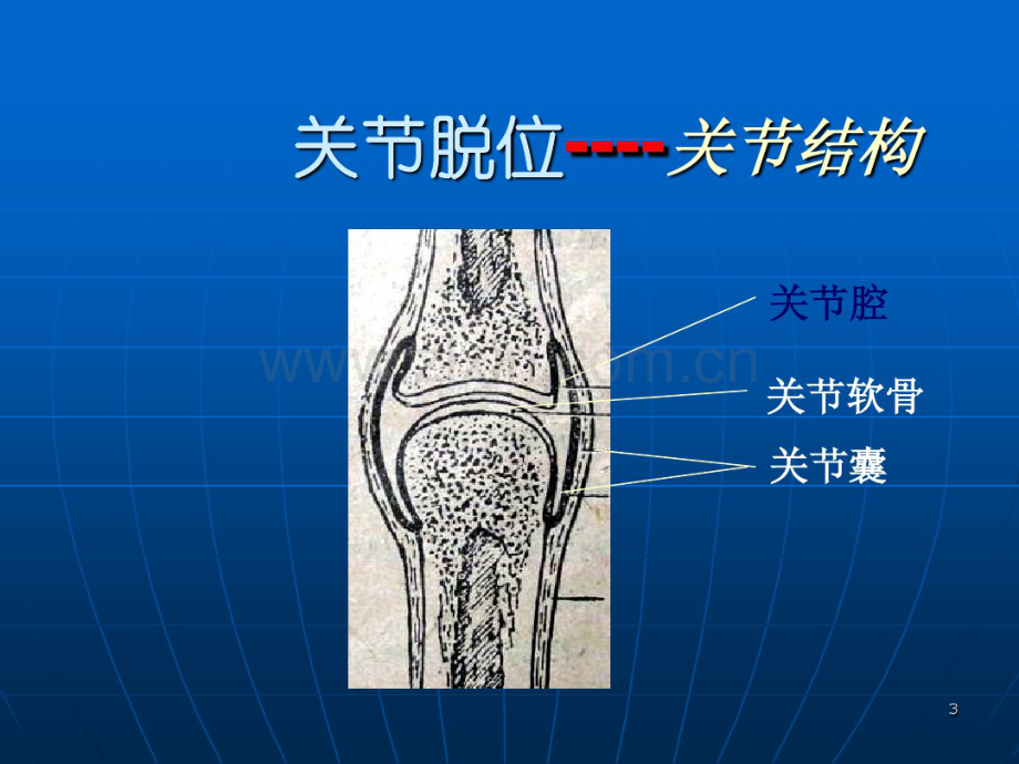 关节脱位.pdf_第3页